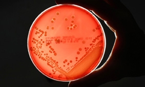 Phát hiện điểm yếu của “siêu vi khuẩn” kháng thuốc
