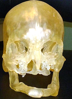 Cải thiện chất lượng các ca ghép mặt nhờ kỹ thuật in 3D