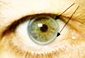 Thêm nhiều dấu hiệu cảnh báo sức khỏe trên mặt và đầu