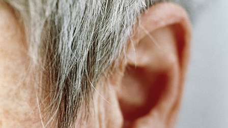 Xét nghiệm da có thể tầm soát sớm Alzheimer và Parkinson