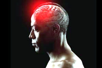 Kỹ thuật kích thích não sâu không xâm lấn