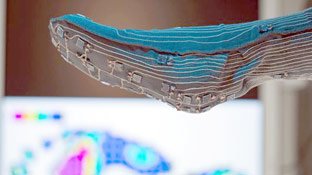 Vớ cảm biến giúp bảo vệ chân bệnh nhân tiểu đường