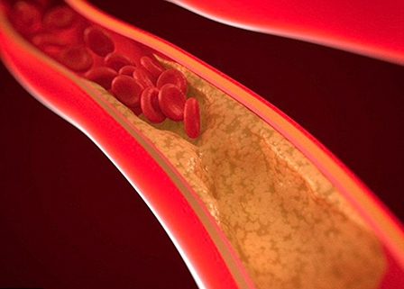 Xem ảnh động mạch giúp bệnh nhân tăng động lực 

cải thiện lối sống