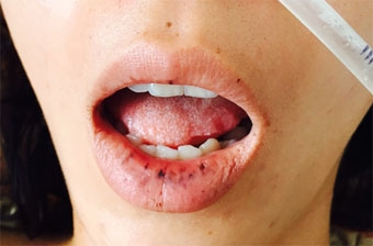 Chẩn đoán, điều trị các bệnh hiếm, lạ