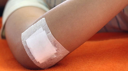 Băng gạc mới giúp vết thương ở bệnh nhân tiểu đường 

mau lành