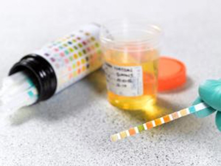 Thiết bị mới giúp phát hiện 
nhiễm trùng đường tiểu cực nhanh