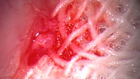 Thử nghiệm thành công thận nuôi 
trong phòng thí nghiệm