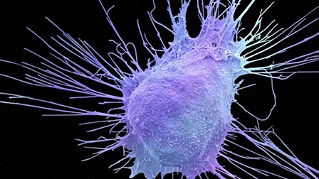 Trị ung thư tuyến tiền liệt bằng Olaparib