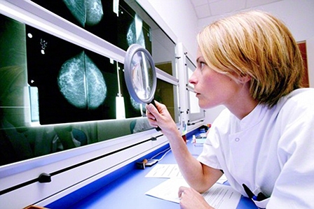 Kỹ thuật MRI mới giúp nhận diện sớm khối u xâm lấn