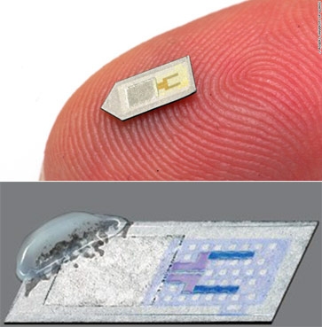 Giám sát não bị chấn thương bằng cảm biến tự phân hủy