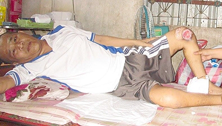 Bệnh nặng nhưng không có tiền chữa trị