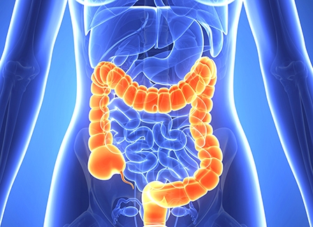 10 cách phòng ngừa ung thư đại tràng