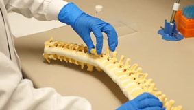 Vật liệu mới hỗ trợ điều trị tổn thương cột sống