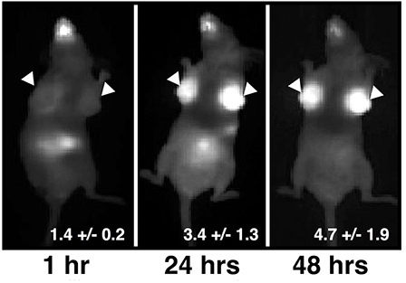 Thuốc viên tối ưu hóa kỹ thuật chẩn đoán ung thư vú