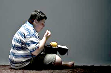 Béo phì ở tuổi thiếu niên và nguy cơ chết sớm khi trưởng thành