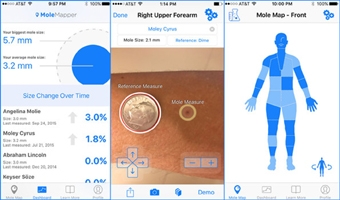 4 công nghệ hỗ trợ phòng tránh ung thư da