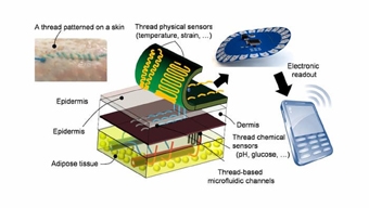 Chỉ khâu thông minh