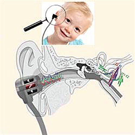 Kiểm tra thính lực giúp xác định nguy cơ tự kỷ ở trẻ nhỏ
