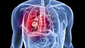 Công nghệ quét 4D hỗ trợ điều trị các vấn đề ở phổi