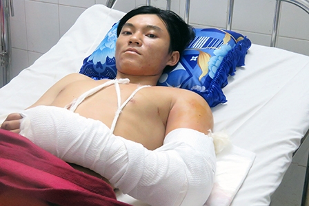 Một thanh niên bị máy hút lúa
cuốn dập nát cánh tay