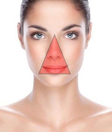 Cảnh báo “vùng nguy hiểm” trên khuôn mặt cấm nặn mụn