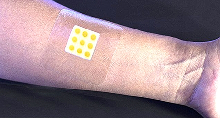 Miếng dán đổi màu cảnh báo sớm nhiễm trùng vết thương