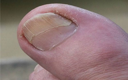 Dấu hiệu cơ thể cần bổ sung dưỡng chất đặc biệt