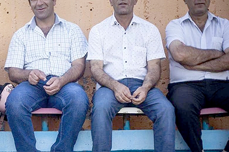 Điều trị sớm ung thư tiền liệt tuyến không cần phẫu thuật