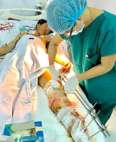 Nối thành công cẳng chân giập nát do xe tải cán