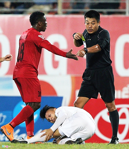 Tiếng còi V.League lại “méo”