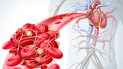 Sợi quang giúp cảnh báo nguy cơ đông máu khi phẫu thuật