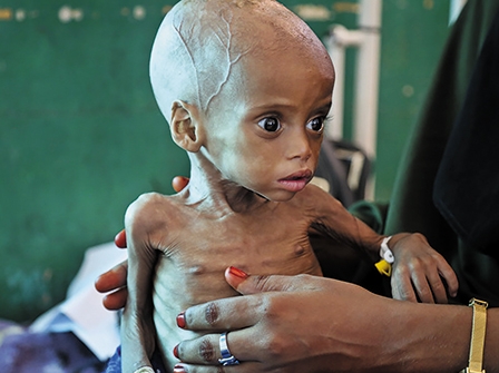 Thế giới đối mặt khủng hoảng nhân đạo tồi tệ nhất từ năm 1945