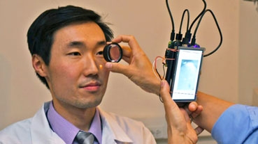 Tiềm năng thiết bị chụp ảnh võng mạc bỏ túi