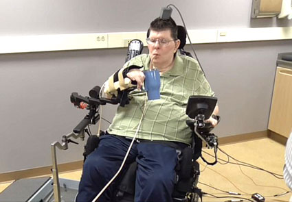 Thiết bị cấy ở não và cánh tay
giúp người bị liệt cử động trở lại