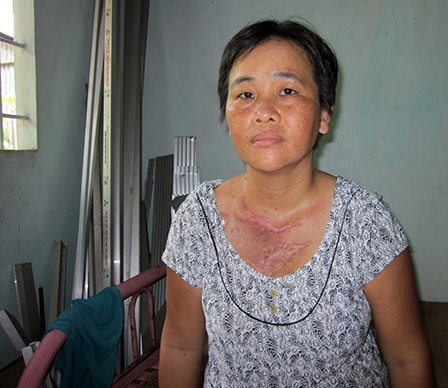 Chị Bạch cần được giúp đỡ tiếp tục trị bệnh