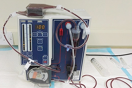 Máy lọc máu từ tính 

hứa hẹn cứu sống 

nhiều người