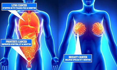 Những đột phá mới trong cuộc chiến chống ung thư