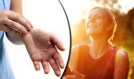 Phơi nắng giảm triệu chứng chàm eczema
