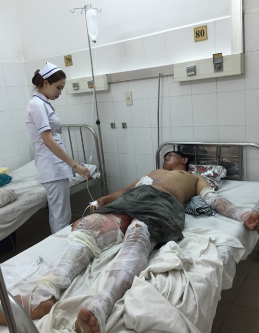 Ăn tiệc cưới, 11 người bỏng cồn