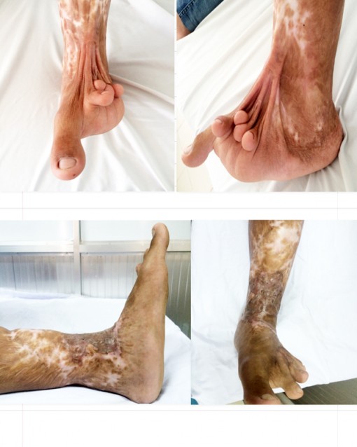 Tạo hình, thẩm mỹ cho những người kém may mắn