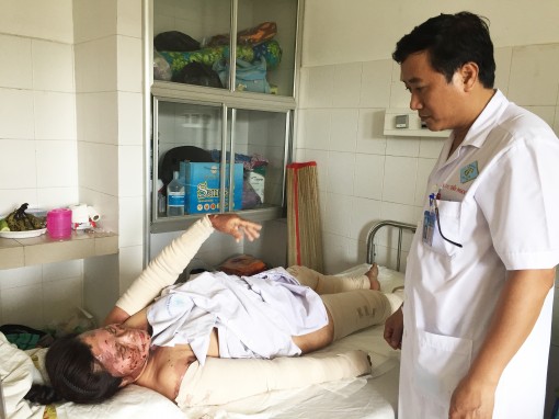 Nấu nước trên bếp gas, 3 người bỏng nặng