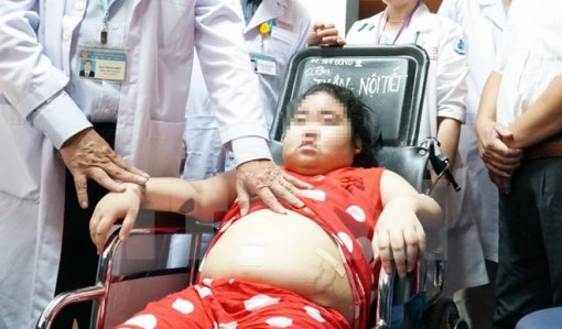 Can thiệp thành công cho bệnh nhi mắc hội chứng Cushing hiếm gặp