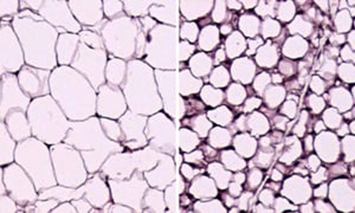 Phương pháp mới chuyển hóa mỡ giúp chữa béo phì