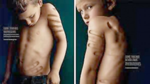 Vì sao trẻ bị ngược đãi

dễ bị rối loạn tâm thần?