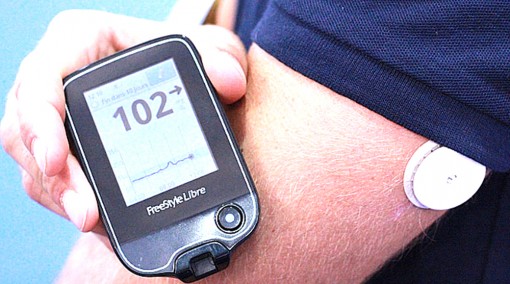 FDA phê chuẩn hệ thống theo dõi đường huyết liên tục