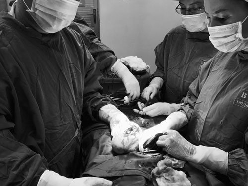 Cứu sống thai phụ nguy kịch do sốt xuất huyết