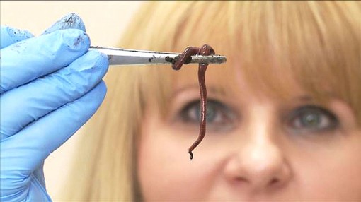 Tiềm năng điều trị ung thư phổi từ giun đất