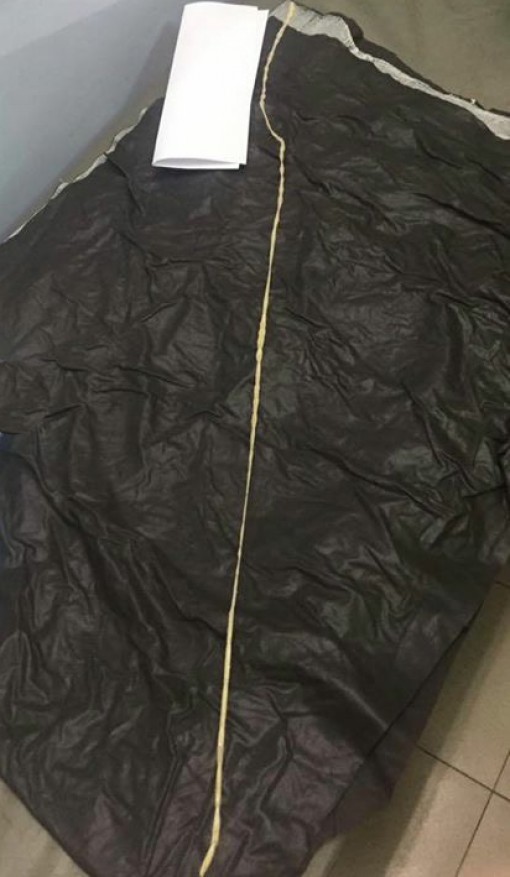 Nội soi gắp con sán xơ mít dài 1,2m