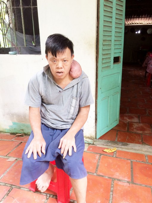 Mồ côi cha mẹ, bệnh tật triền miên