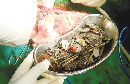 Nuốt 263 đồng xu

và 100 cây đinh